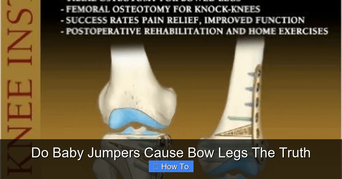 Do Baby Jumpers Cause Bow Legs The Truth
