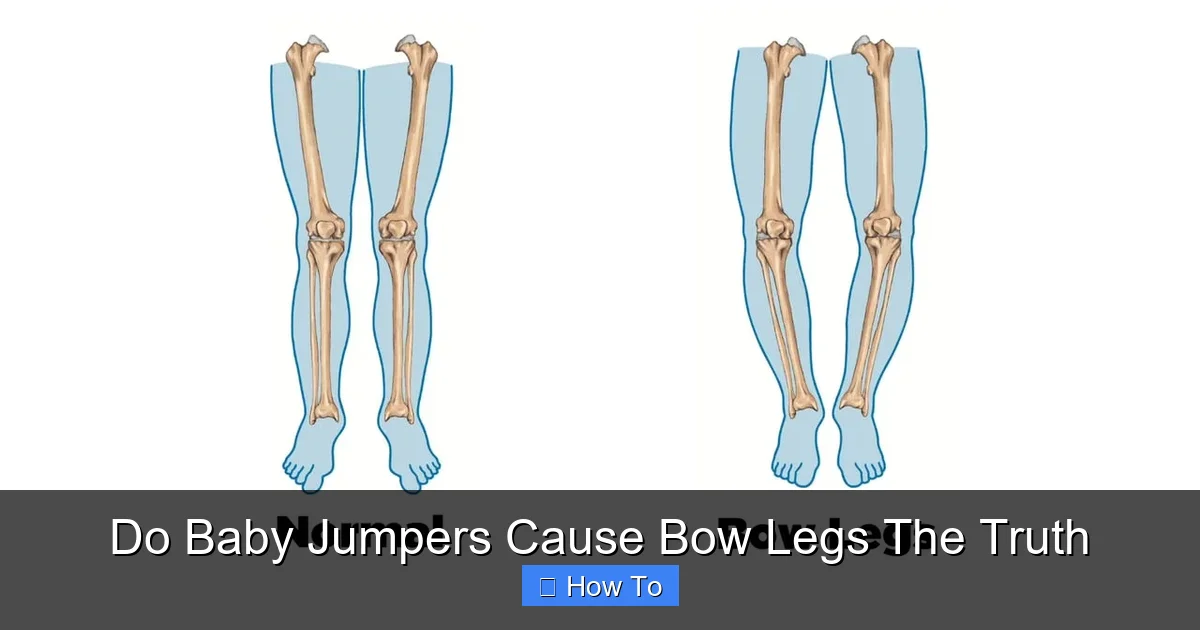 Do Baby Jumpers Cause Bow Legs The Truth