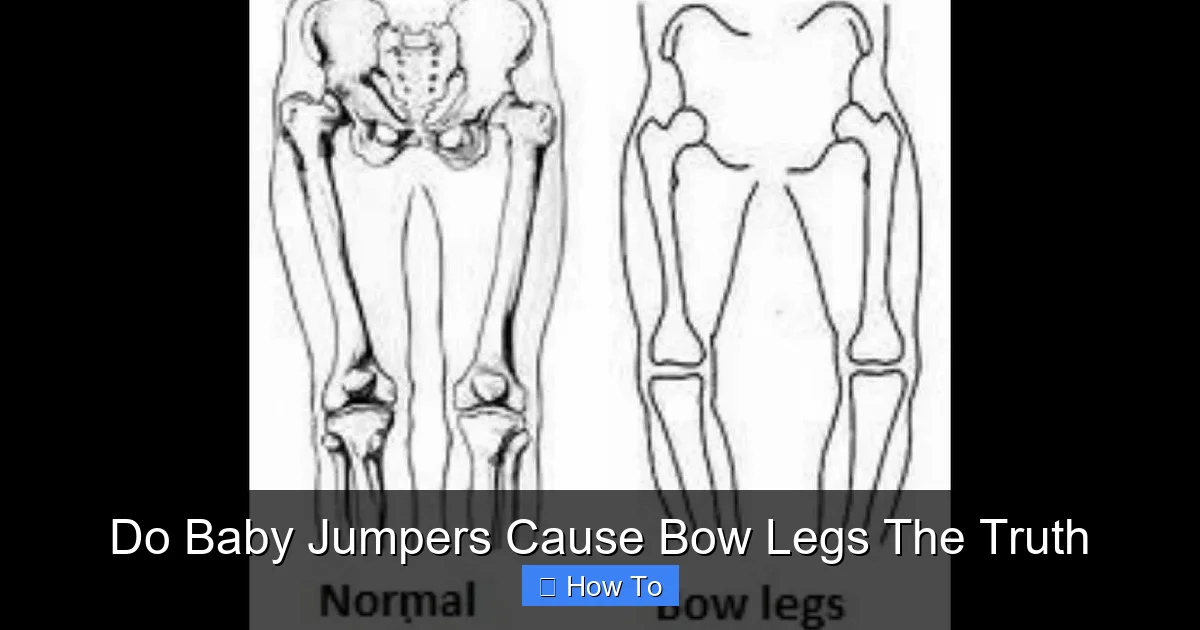 Do Baby Jumpers Cause Bow Legs The Truth